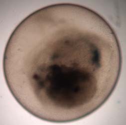 dead embryo